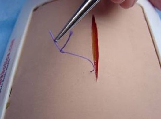 Suturing